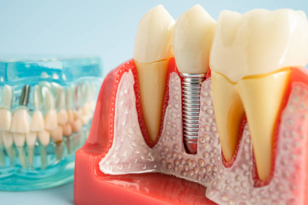 Best Laser Dentistry  in Rantoul, IL